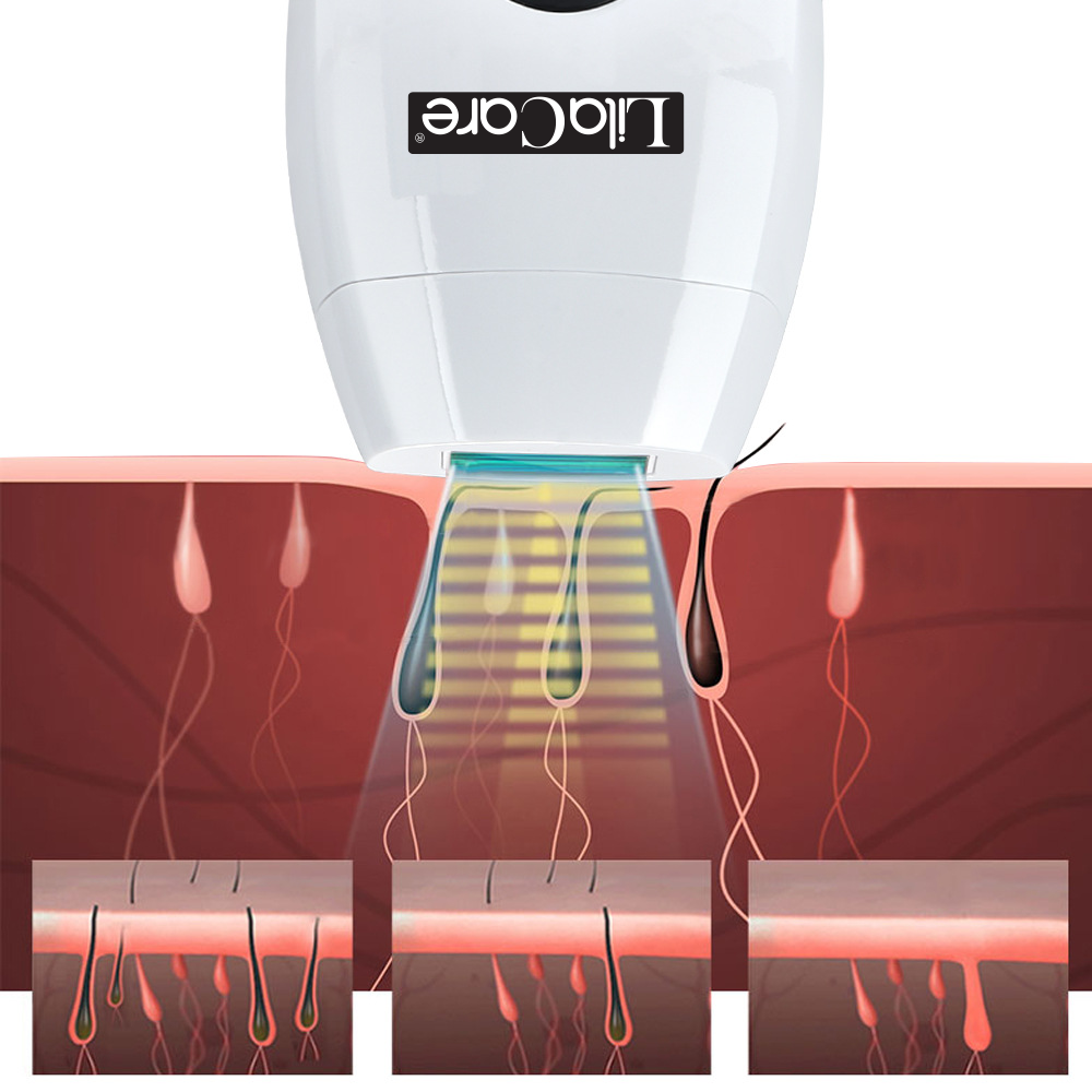 Epilator IPL Lila Care, epilare definitiva, 600.000 pulsatii, cu display LCD, 8 trepte de putere, Alb / Negru, [5],https:lilarossa.ro