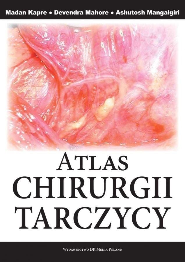 Atlas de chirurgie tiroidiană