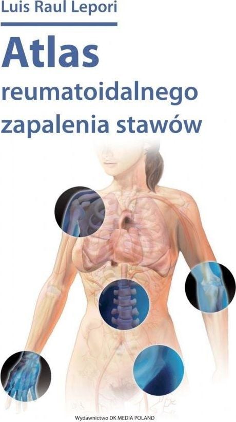 Atlas al artritei reumatoide