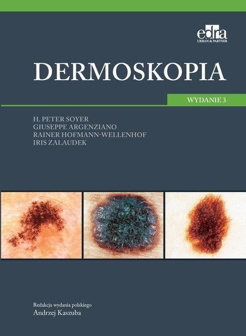 Dermoscopia reprezintă o metodă de diagnostic utilizată în dermatologie pentru a examina cu atenție leziunile cutanate și a distinge între leziuni benigne și cele care pot fi maligne. Această tehnică implică utilizarea unui dispozitiv special numit d