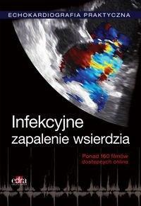 Echokardiografia Praktyczna Infekcyjne zapalenie wsierdzia