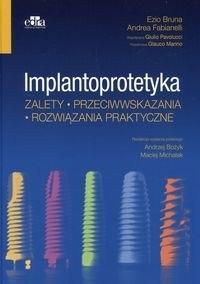 Implantoprotetyka Zalety przeciwwskazania rozwiązania praktyczne