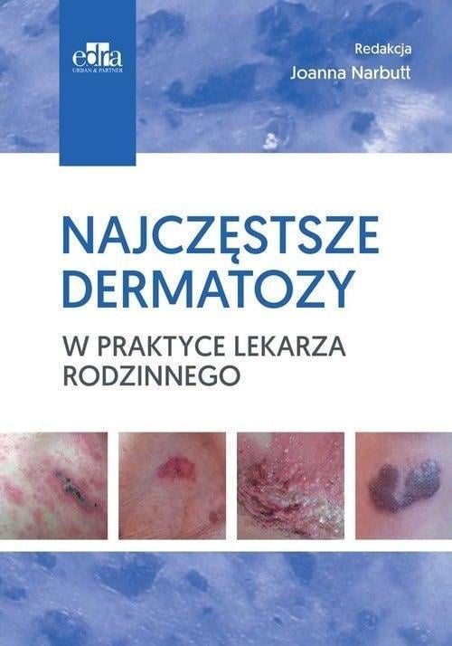 Najczęstsze dermatozy w praktyce lekarza rodzinnego