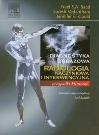 imaginea transesofagianaPortretele bicifelor popoare Radiologia vasculară și intervențională se referă la imaginile trans-esofagiene în limba română.