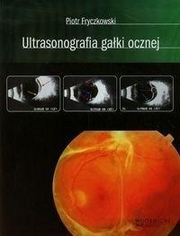 Ultrasonografia globului ocular