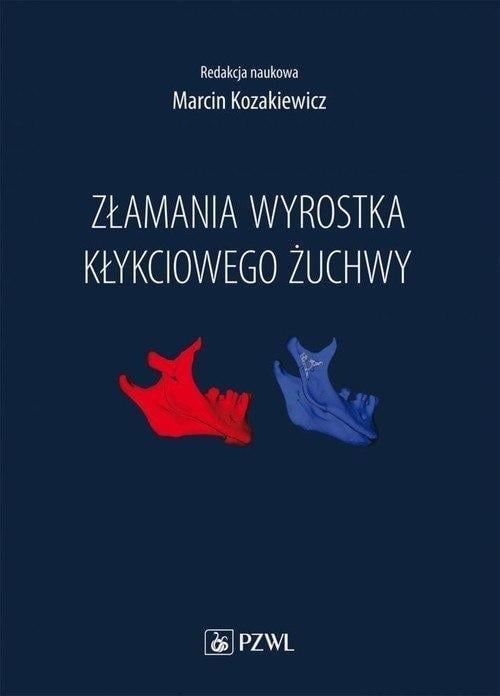 Fracturi ale procesului condilar al mandibulei