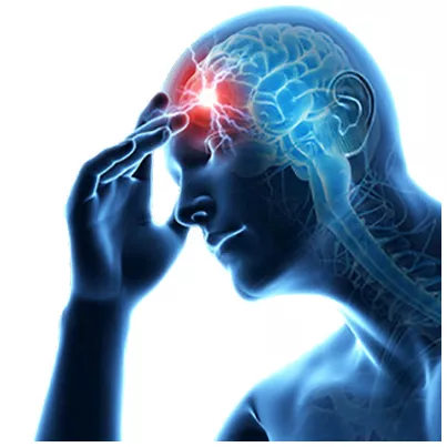 Accidentul vascular cerebral (AVC) - factori de risc, simptome, preventie