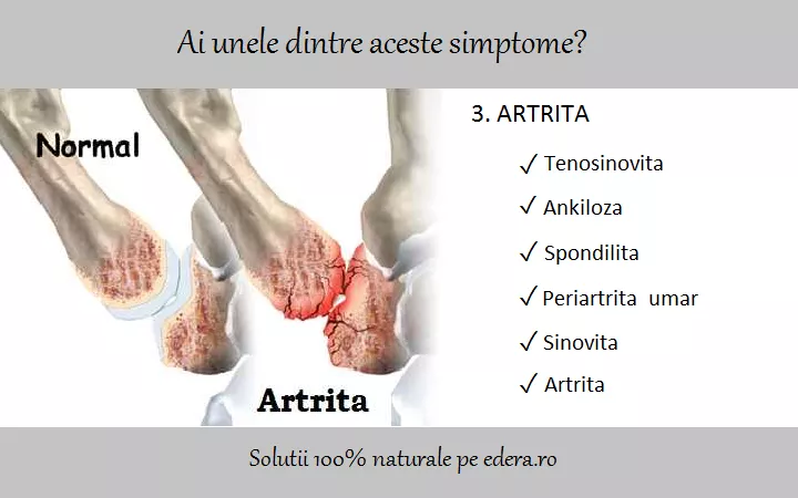 Artrita