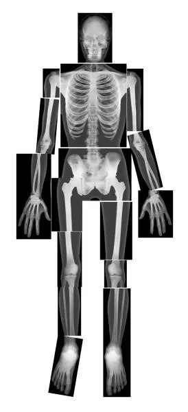 Radiografii ale corpului uman