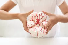 Creierul uman cu artere - model anatomic