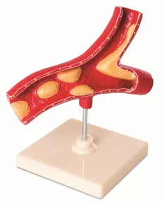 Structura artera - model