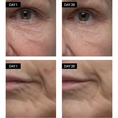 RENEWING SERUM