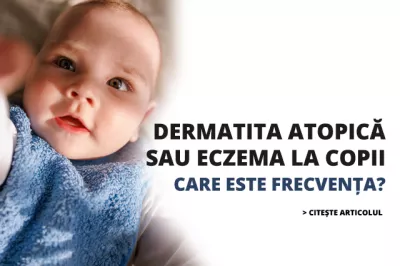 Dermatita atopică sau eczema la copii. Care este frecvența?