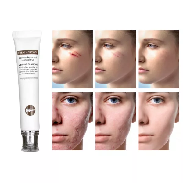 Față - Creme şi Geluri - ﻿Gel reparator 20 gr., edera.ro