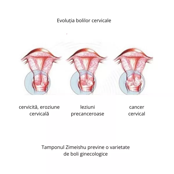 Tampon Zimeishu 2 pachete