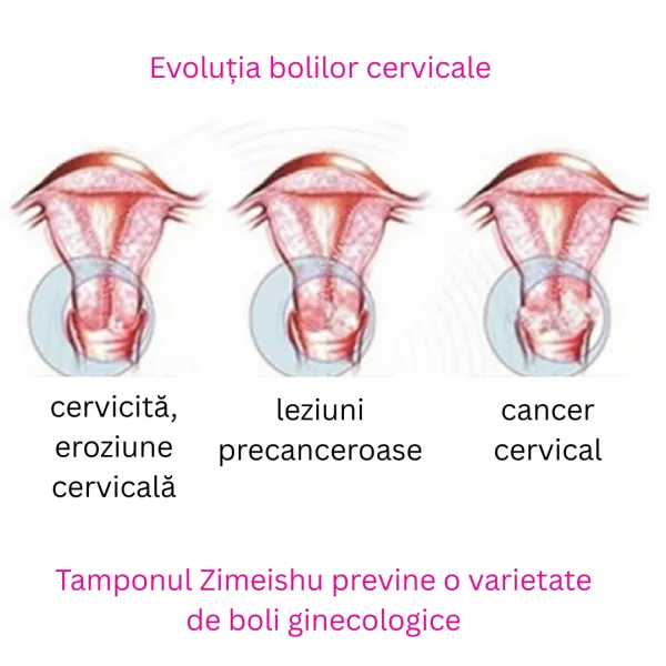 Tampon Zimeishu Set 2 pachete
