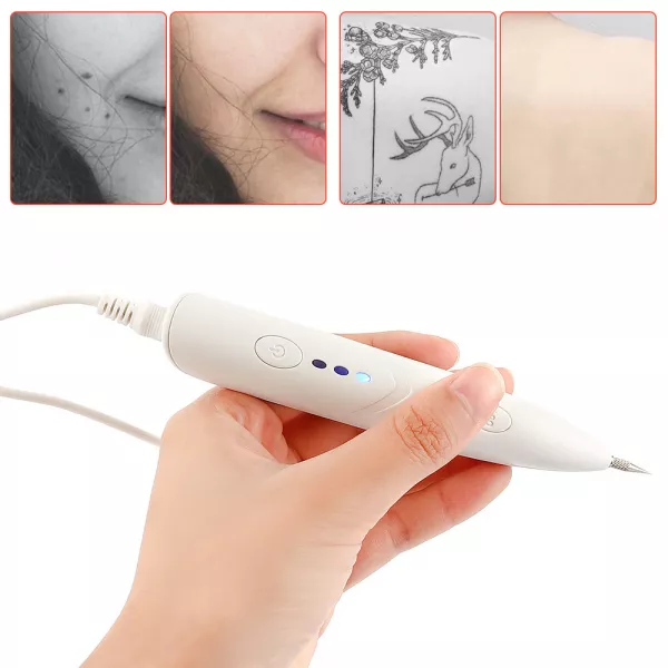 Aparat cosmetic plasma Lila Care, alb, pentru indepartarea alunitelor, pentru indepartarea pistruilor si tatuajelor
