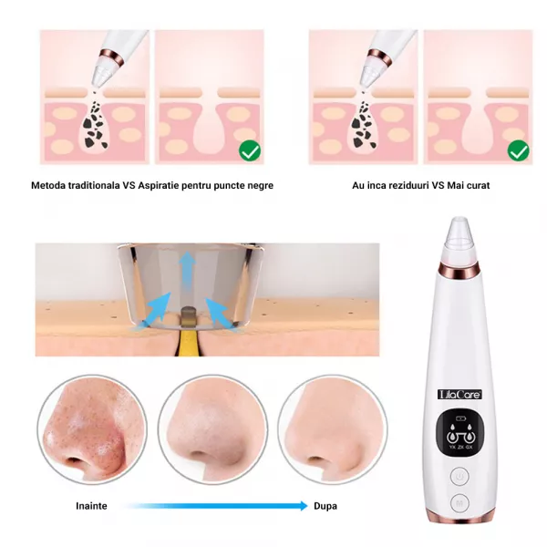 Aspirator facial Lila Care, ingrijire ten, indepartarea punctelor negre, minimizarea porilor, putere de aspirare mare, 6 capete inlocuibile, 7 nivele de rezistenta, portabil, alb