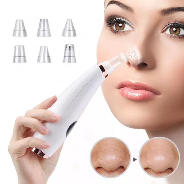 Aspirator facial Lila Care, ingrijire ten, indepartarea punctelor negre, minimizarea porilor, putere de aspirare mare, 6 capete inlocuibile, 7 nivele de rezistenta, portabil, alb