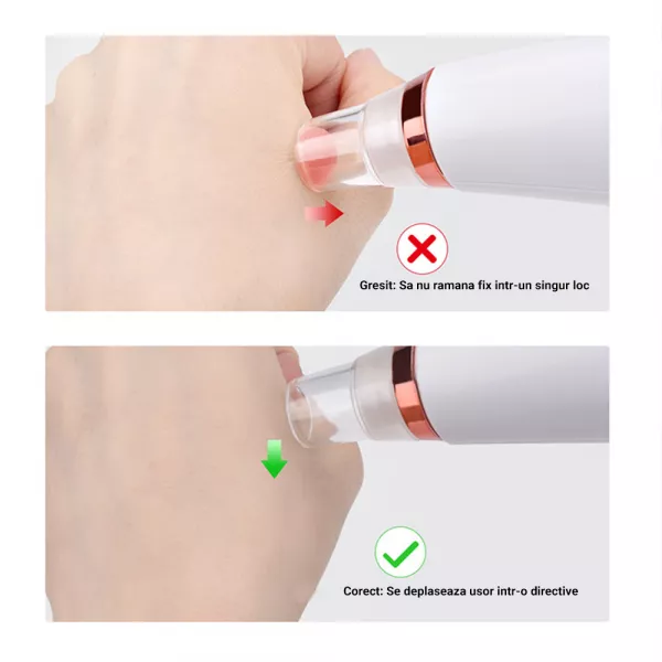 Aspirator facial Lila Care, ingrijire ten, indepartarea punctelor negre, minimizarea porilor, putere de aspirare mare, 6 capete inlocuibile, 7 nivele de rezistenta, portabil, alb