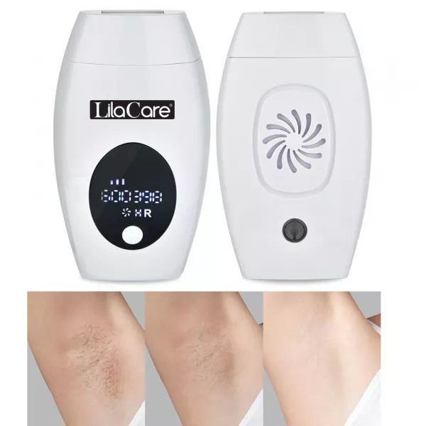 Epilator IPL Lila Care, epilare definitiva, 600.000 pulsatii, cu display LCD, 8 trepte de putere, Alb / Negru